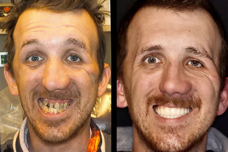 Before After Image