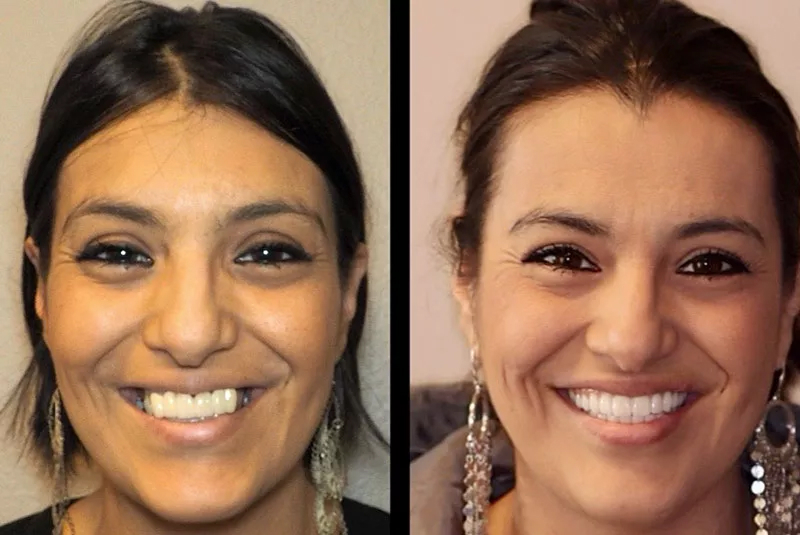 Before After Image